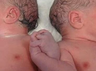 Фото заслуживает миллион слов. 14 мая в Барселоне родились близнецы. Вся больница сбежалась, чтобы увидеть незабываемую картину. Руки близнецов переплетались. Это прекрасный жест, чтобы запомнить навсегда!!!