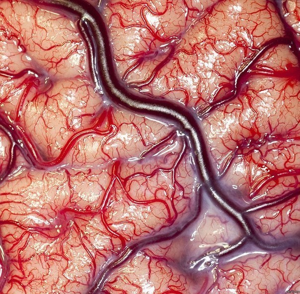 Живой человеческий мозг. потрясающее фото..